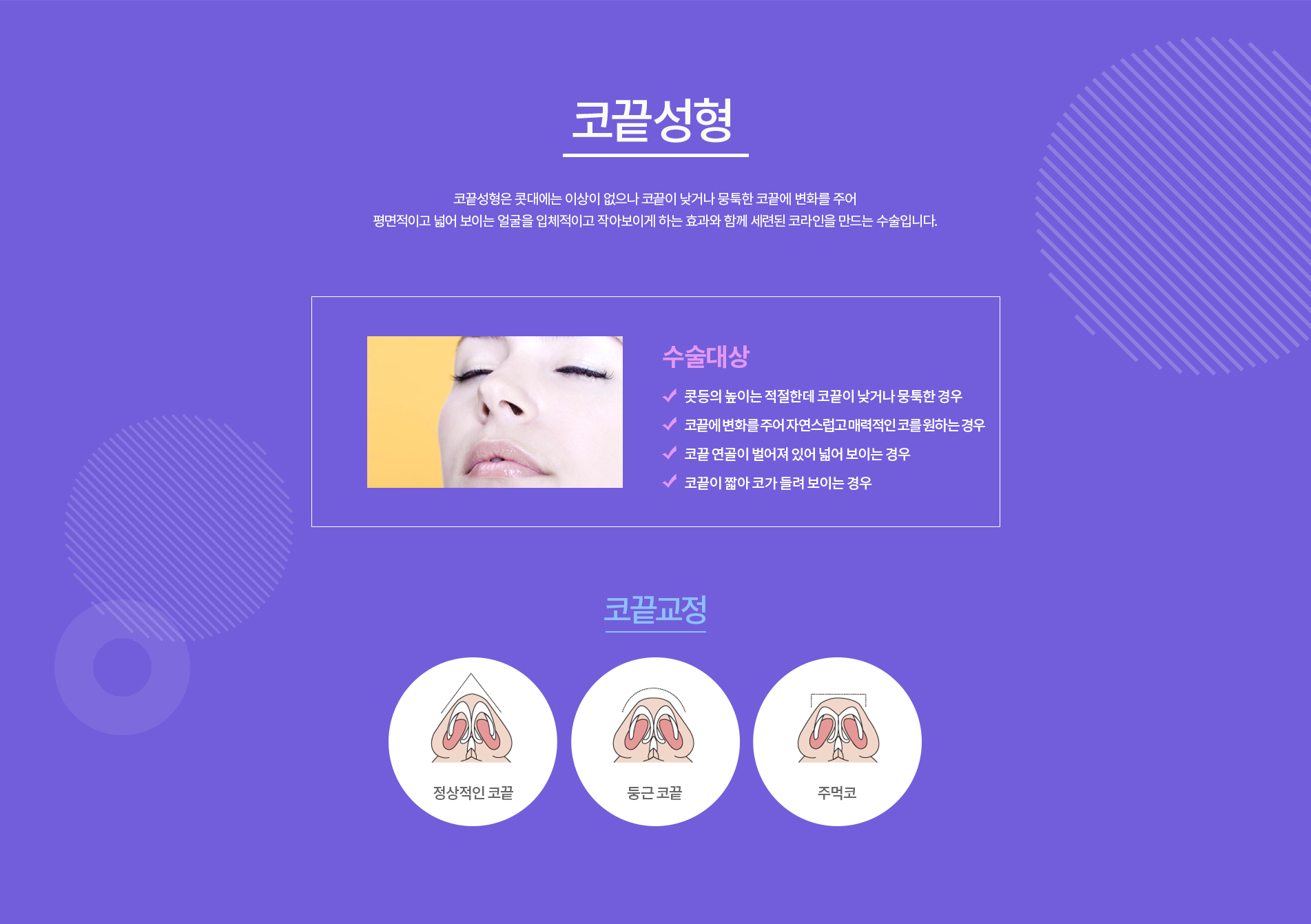 코끝성형